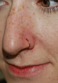 Great nose piercing!