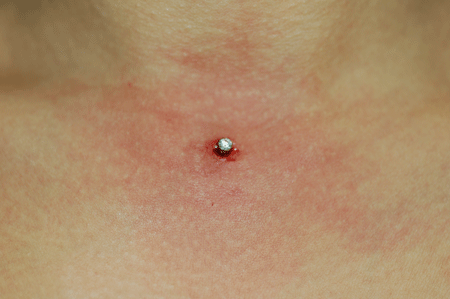 Great place for a dermal