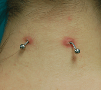 christina piercing infection