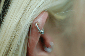Better quality jewelry in her cartilage to combat the crusting...