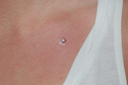 What a beautiful addition to her chest!