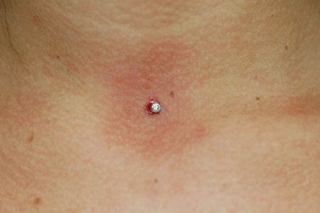 Such a great location for a dermal