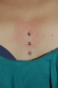 Dermals for days